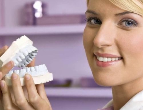 As 4 Perguntas Mais Comuns Sobre Cuidados com Implantes Dentários