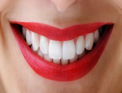 Clareamento Dental: O que você precisa saber antes, durante e depois do clareamento