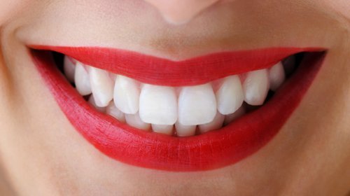 Clareamento Dental: O que você precisa saber antes, durante e depois
